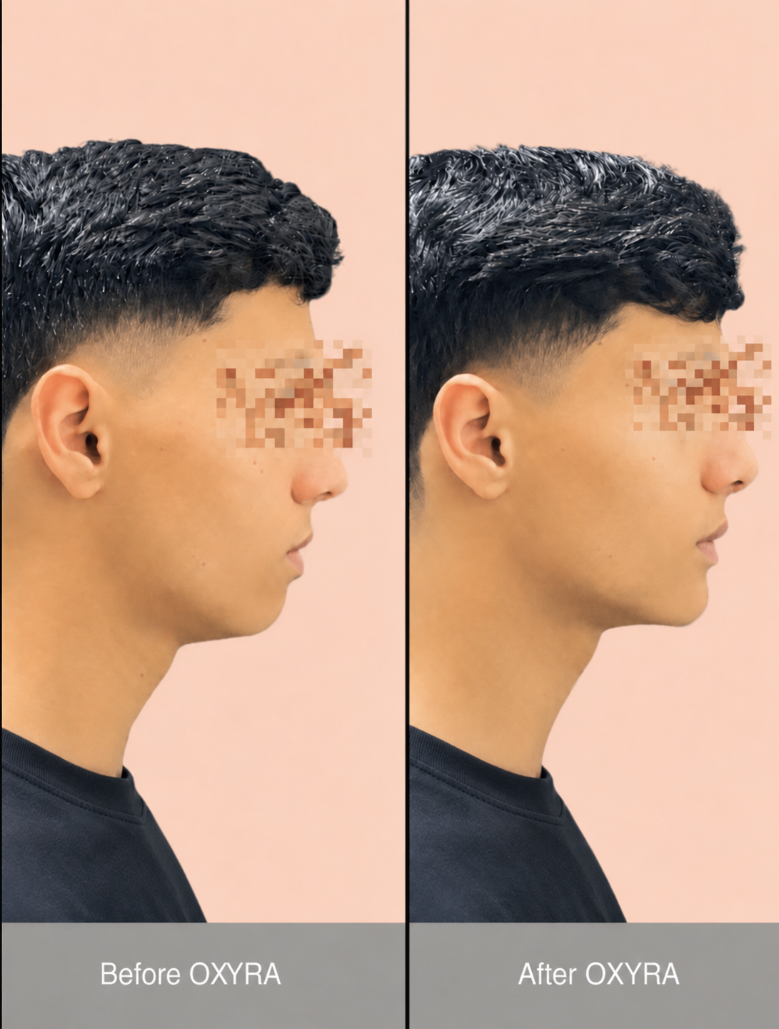 OXYRA Mouth Tape Pro